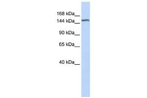 DGKH antibody used at 1 ug/ml to detect target protein. (DGKH anticorps  (Middle Region))