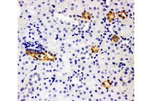 Anti-SLC12A1 antibody, IHC(P) IHC(P): Rat Kidney Tissue (SLC12A1 anticorps  (N-Term))