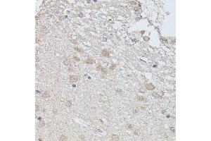 Immunohistochemistry of paraffin-embedded rat brain using PP2A-B56δ/PR61δ/PP2A-B56δ/PR61δ/PPP2R5D antibody (ABIN7269690) at dilution of 1:100 (40x lens).
