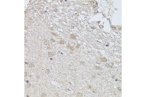 Immunohistochemistry of paraffin-embedded rat brain using PP2A-B56δ/PR61δ/PP2A-B56δ/PR61δ/PPP2R5D antibody (ABIN7269690) at dilution of 1:100 (40x lens). (PPP2R5D anticorps  (AA 450-550))