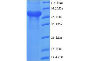 SDS-PAGE (SDS) image for THAP Domain Containing 11 (THAP11) (AA 1-313), (partial) protein (His-SUMO Tag) (ABIN5711644)