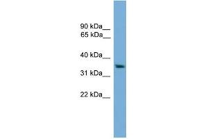 WB Suggested Anti-RAD51L1 Antibody Titration: 0. (RAD51 Homolog B anticorps  (Middle Region))