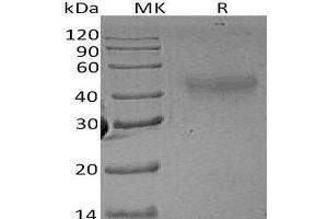 Western Blotting (WB) image for Colony Stimulating Factor 1 (Macrophage) (CSF1) protein (ABIN7321260) (M-CSF/CSF1 Protéine)