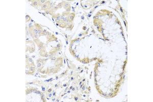 Immunohistochemistry of paraffin-embedded human gastric using INPP5K antibody at dilution of 1:100 (x40 lens). (INPP5K anticorps)