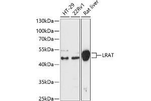 Western blot analysis of extracts of various cell lines, using Lrat antibody (ABIN6132017, ABIN6143311, ABIN6143314 and ABIN6217073) at 1:3000 dilution. (LRAT anticorps  (AA 31-150))