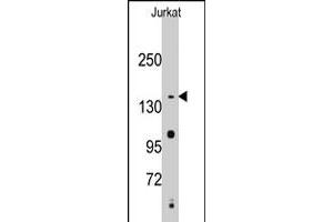 Western blot analysis of SMC2 polyclonal antibody  in Jurkat cell line lysates (35 ug/lane). (SMC2 anticorps  (C-Term))