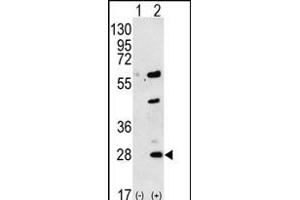 Western blot analysis of GREM1 (arrow) using rabbit polyclonal GREM1 Antibody (C-term) (ABIN656181 and ABIN2845510). (GREM1 anticorps  (C-Term))
