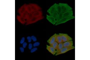ABIN7096934 and ABIN7101000 staining Hela cells(30 min of UV treatment) by IF/ICC. (PTPLAD2 anticorps)