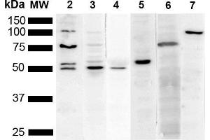 Western Blot analysis of Human Cervical cancer cell line (HeLa) lysate showing detection of Multiple KDEL protein using Mouse Anti-KDEL Monoclonal Antibody, Clone 2C1 (ABIN5650522). (KDEL anticorps  (N-Term) (Biotin))