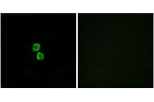 Immunofluorescence analysis of MCF7 cells, using CKLF1 Antibody.
