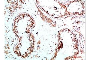 Immunohistochemical analysis of paraffin-embedded human-testis, antibody was diluted at 1:200 (IL-31 anticorps  (AA 21-70))