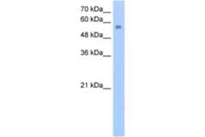 Western Blotting (WB) image for anti-Nudix (Nucleoside Diphosphate Linked Moiety X)-Type Motif 12 (NUDT12) antibody (ABIN2463240) (NUDT12 anticorps)
