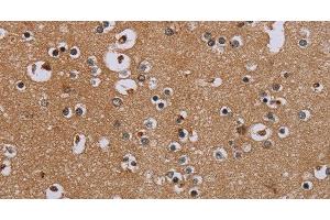 Immunohistochemistry of paraffin-embedded Human brain tissue using IFRD1 Polyclonal Antibody at dilution 1:40 (IFRD1 anticorps)