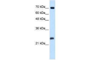 WB Suggested Anti-SERTAD1 Antibody Titration:  0. (SERTAD1 anticorps  (N-Term))