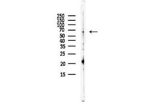 anti-Selenoprotein N, 1 (SEPN1) antibody