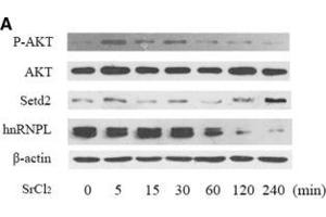 AKT pathway was activated by SrCl2 stimulation in PDLCs.
