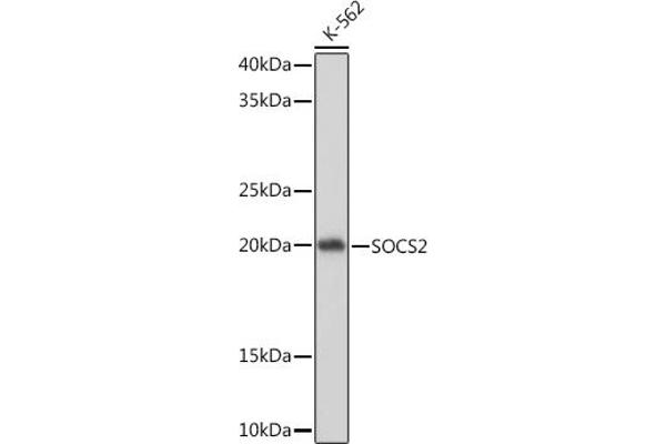 SOCS2 antibody