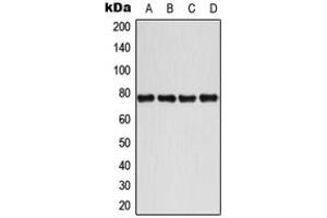 Western blot analysis of BMX (pY40) expression in MCF7 IL1b-treated (A), Jurkat CD3-treated (B), Raw264. (BMX anticorps  (N-Term, pTyr40))