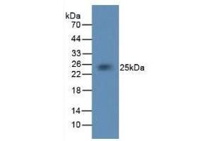 Detection of TF in Rabbit Brain Tissue using Monoclonal Antibody to Tissue Factor (TF)