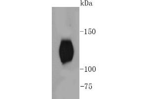 Mouse brain lysates, probed with TrkB(Y817) (2A1 ) Monoclonal Antibody  at 1:1000 overnight at 4˚C. (TRKB anticorps  (pTyr817))