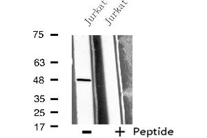 Western blot analysis of extracts from Jurkat cells, using BMP10 antibody. (BMP10 anticorps  (Internal Region))