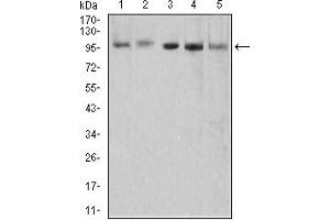 Western Blotting (WB) image for anti-5'-3' Exoribonuclease 2 (XRN2) (AA 398-547) antibody (ABIN5855738)