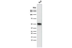 Western Blot Analysis of Raji cell lysate using CD79a Monoclonal Antibody (SPM550). (CD79a anticorps  (AA 202-216))