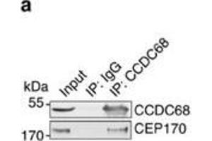 CCDC68 interacts with CEP170 and is localized at the centrosomes. (CCDC68 anticorps)