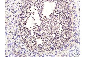 Paraformaldehyde-fixed, paraffin embedded rat ovary tissue, Antigen retrieval by boiling in sodium citrate buffer(pH6) for 15min, Block endogenous peroxidase by 3% hydrogen peroxide for 30 minutes, Blocking buffer (normal goat serum) at 37°C for 20min, Antibody incubation with Rabbit Anti-Estrogen receptor alpha (Ser118) Polyclonal Antibody, Unconjugated  at 1:400 overnight at 4°C, followed by a conjugated secondary and DAB staining (Estrogen Receptor alpha anticorps  (pSer118))
