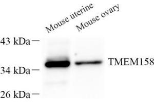 Western blot analysis of TMEM158 (ABIN7075993) at dilution of 1: 500 (TMEM158 anticorps)