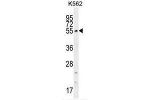 CCDC61 Antibody (N-term) western blot analysis in K562 cell line lysates (35µg/lane). (CCDC61 anticorps  (N-Term))