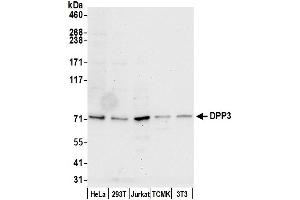 Western Blotting (WB) image for anti-Dipeptidyl-Peptidase 3 (DPP3) (AA 650-700) antibody (ABIN7450184)