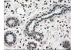Immunohistochemical staining of paraffin-embedded breast tissue using anti-SCYL3 mouse monoclonal antibody. (SCYL3 anticorps)