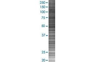 MDM2 transfected lysate. (MDM2 293T Cell Transient Overexpression Lysate(Denatured))