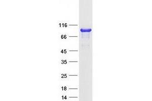 Validation with Western Blot