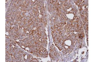 IHC-P Image Immunohistochemical analysis of paraffin-embedded NCI-N87 xenograft, using SEC31A, antibody at 1:100 dilution. (SEC31A anticorps  (N-Term))