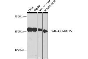Western blot analysis of extracts of various cell lines, using SM/B Rabbit mAb  at 1:500 dilution.
