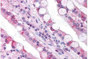 anti-Claudin 18 (CLDN18) (C-Term) antibody