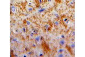 Used in DAB staining on fromalin fixed paraffin-embedded Brain tissue (DKK2 anticorps  (AA 159-258))