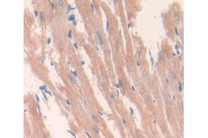 Used in DAB staining on fromalin fixed paraffin- embedded heart tissue (DNASEX anticorps  (AA 19-302))