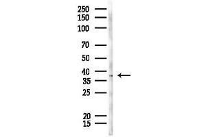 anti-Epididymal Sperm Binding Protein 1 (ELSPBP1) (C-Term) antibody