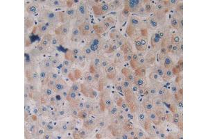 Used in DAB staining on fromalin fixed paraffin- embedded stomach tissue