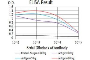 Black line: Control Antigen (100 ng),Purple line: Antigen (10 ng), Blue line: Antigen (50 ng), Red line:Antigen (100 ng)