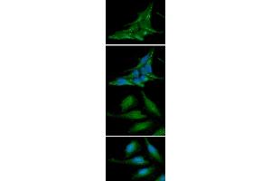 ICC/IF analysis of alpha-synuclein in LnCap cells line, stained with DAPI (Blue) for nucleus staining and monoclonal anti-human alpha-synuclein antibody (1:100) with goat anti-mouse IgG-Alexa fluor 488 conjugate (Green) ICC/IF analysis of alpha-synuclein in HeLa cells line, stained with DAPI (Blue) for nucleus staining and monoclonal anti-human alpha-synuclein antibody (1:100) with goat anti-mouse IgG-Alexa fluor 488 conjugate (Green)