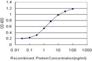 Detection limit for recombinant GST tagged MTF1 is approximately 0.