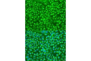 Immunofluorescence analysis of U2OS cells using GZMA antibody.