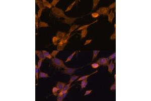 Immunofluorescence analysis of NIH-3T3 cells using UBQLN2 Polyclonal Antibody (ABIN6127815, ABIN6149859, ABIN6149860 and ABIN6225041) at dilution of 1:100 (40x lens).