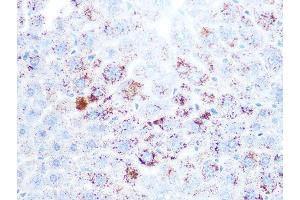 Immunohistochemistry of paraffin-embedded mouse liver using Cathepsin L/V/K/H Rabbit mAb (ABIN7266150) at dilution of 1:100 (40x lens).