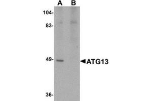 Western blot analysis of ATG13 in rat heart tissue lysate with ATG13 antibody at 1 μg/ml in (A) the absence and (B) the presence of blocking peptide. (ATG13 anticorps  (C-Term))