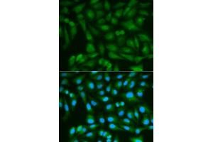 Immunofluorescence analysis of MCF7 cell using SORD antibody. (SORD anticorps  (AA 1-357))